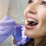 Comprehensive Orthodontic Services in Liverpool: What to Expect