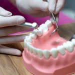 Navigating the Journey to a Perfect Smile with Dental Implants