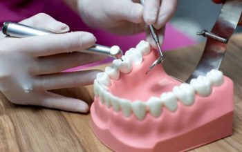 Navigating the Journey to a Perfect Smile with Dental Implants