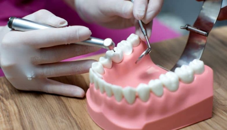 Navigating the Journey to a Perfect Smile with Dental Implants