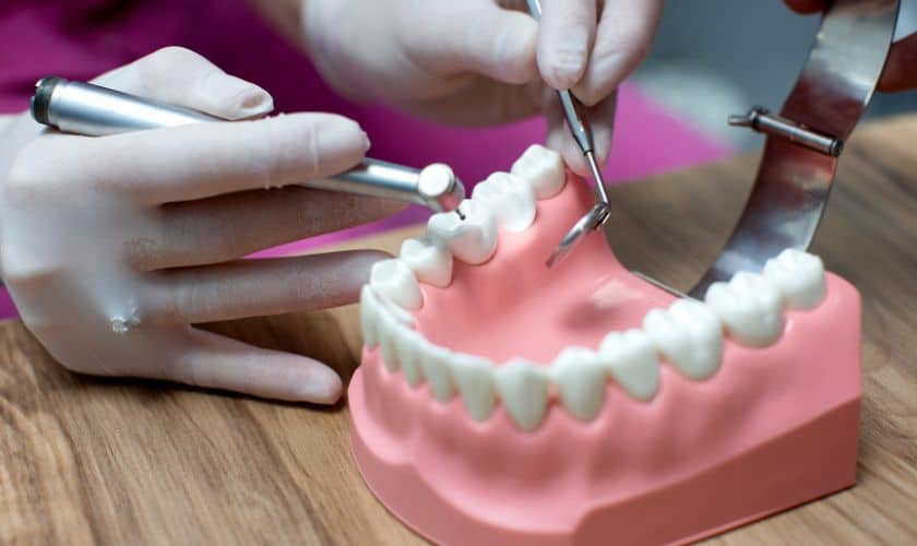 Navigating the Journey to a Perfect Smile with Dental Implants